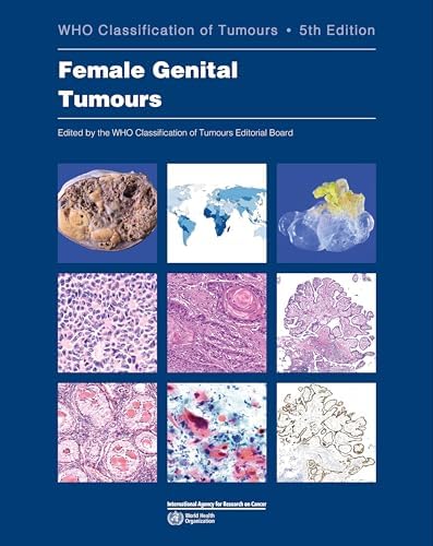 Breast Tumours: WHO Classification of Tumours (Medicine